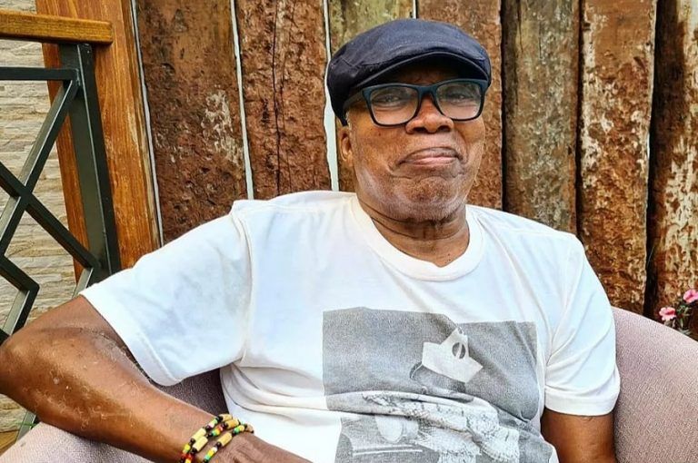 Milton Nascimento Sem Suas Marcantes Tranças