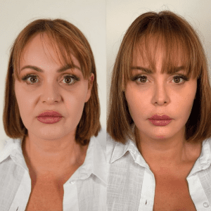 Picwish_answer_image